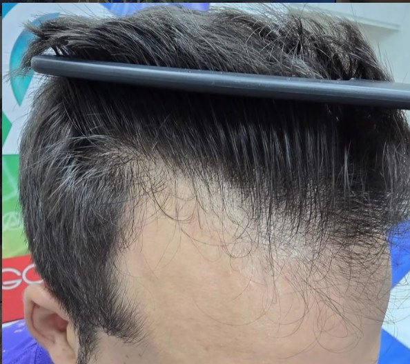 Zona frontal y entradas antes